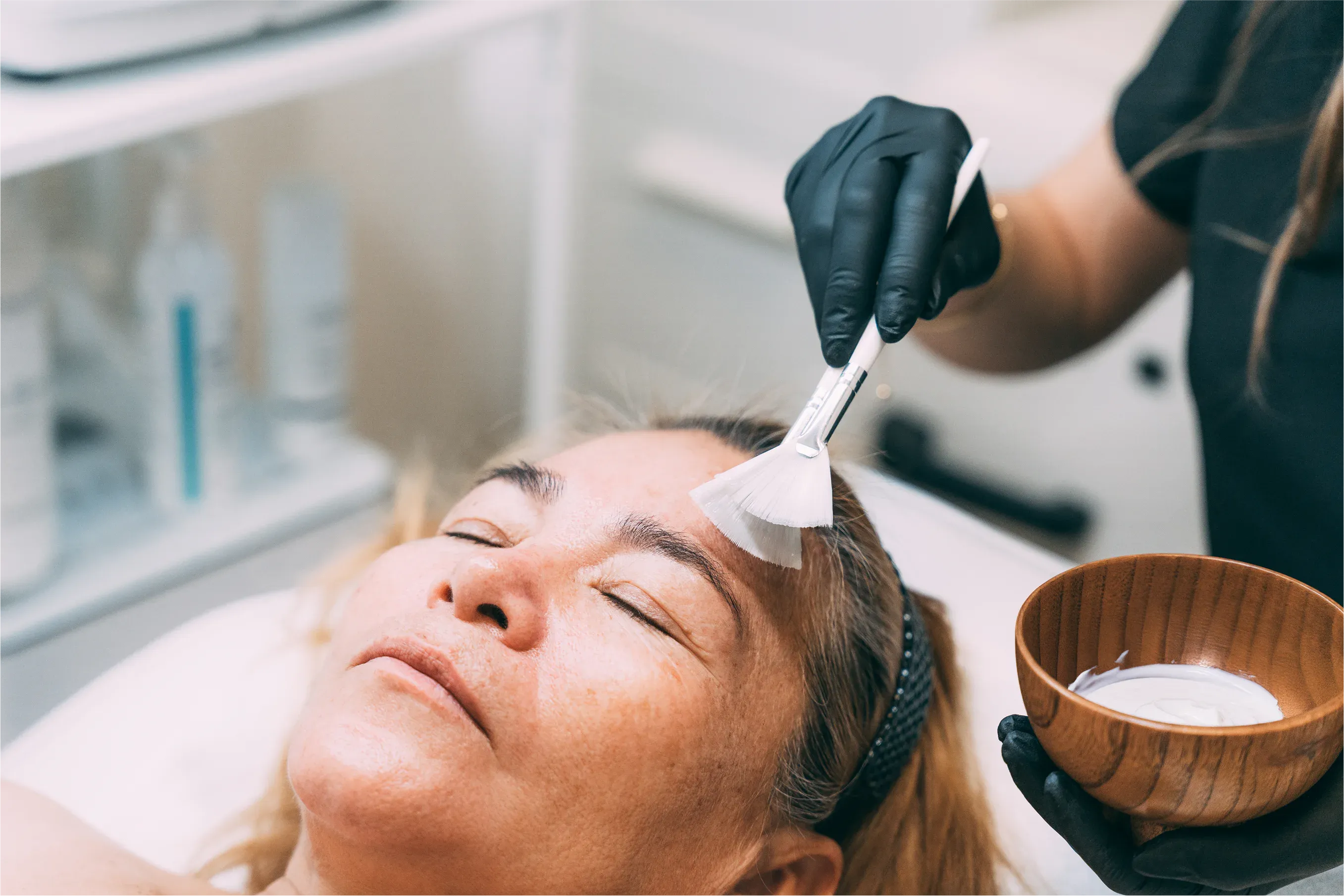 Microneedling Klassik bei Val Luna Beauty